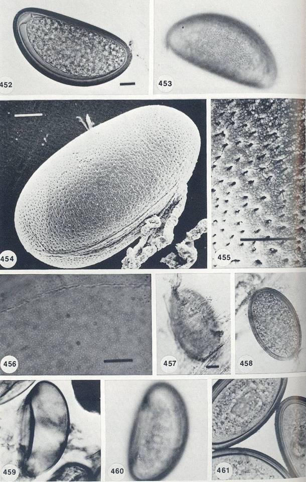 Coelomomyces image