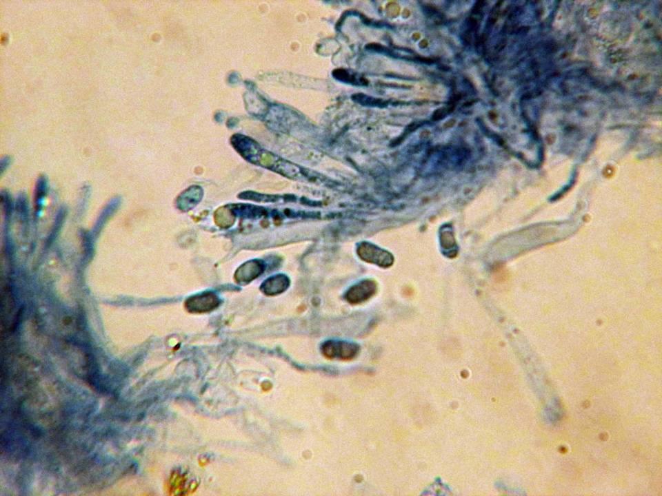 Vuilleminia cystidiata image