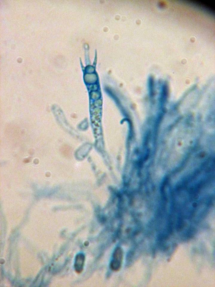 Vuilleminia cystidiata image