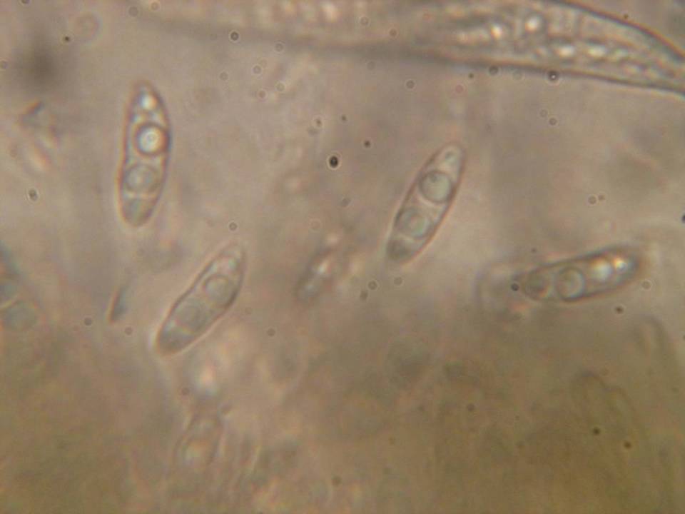 Dencoeliopsis image