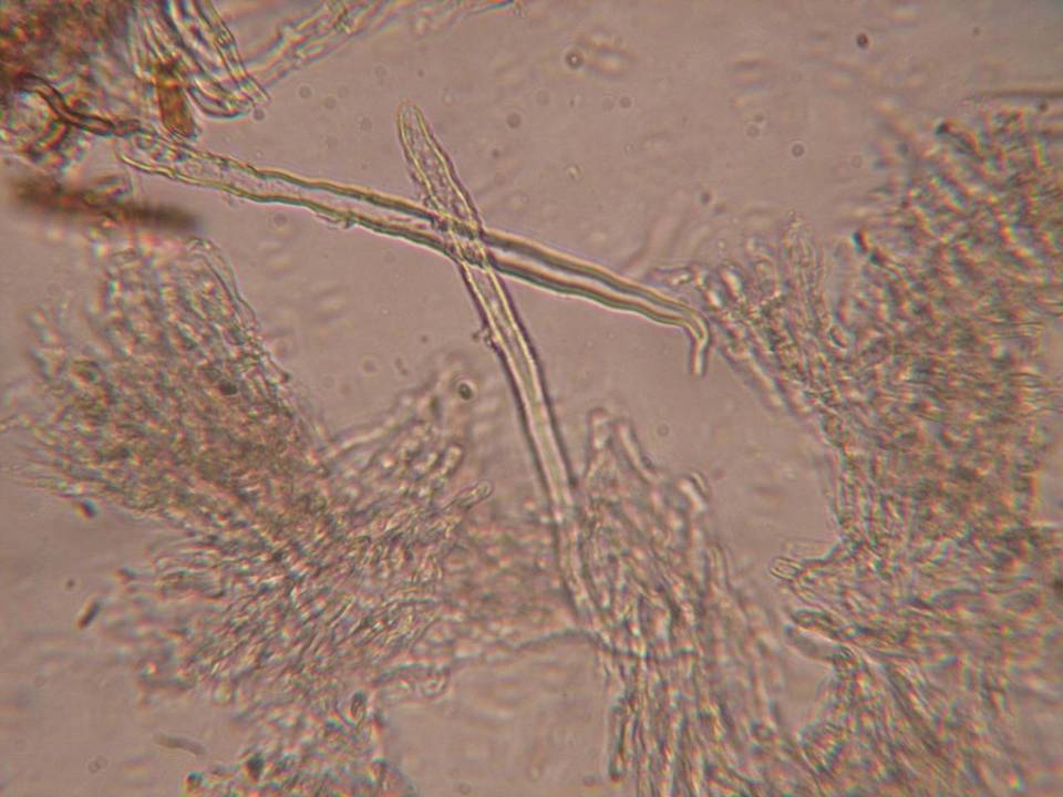 Hyphodontia subalutacea image