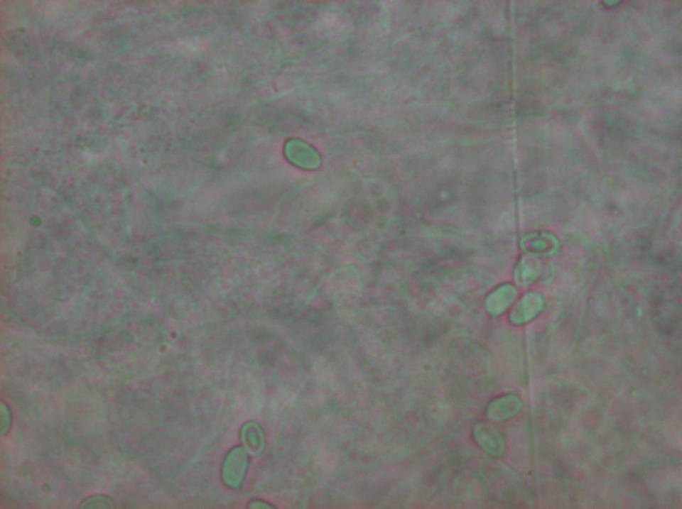 Cystolepiota icterina image