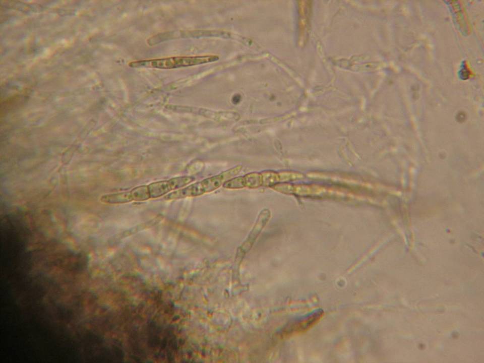Leptosphaeria image