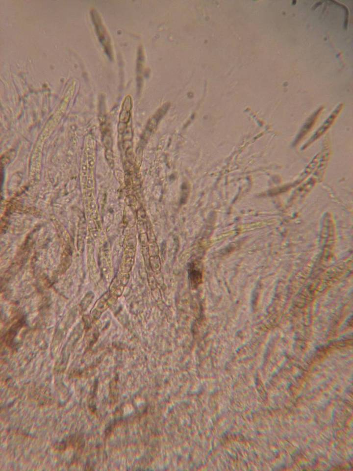 Leptosphaeria image