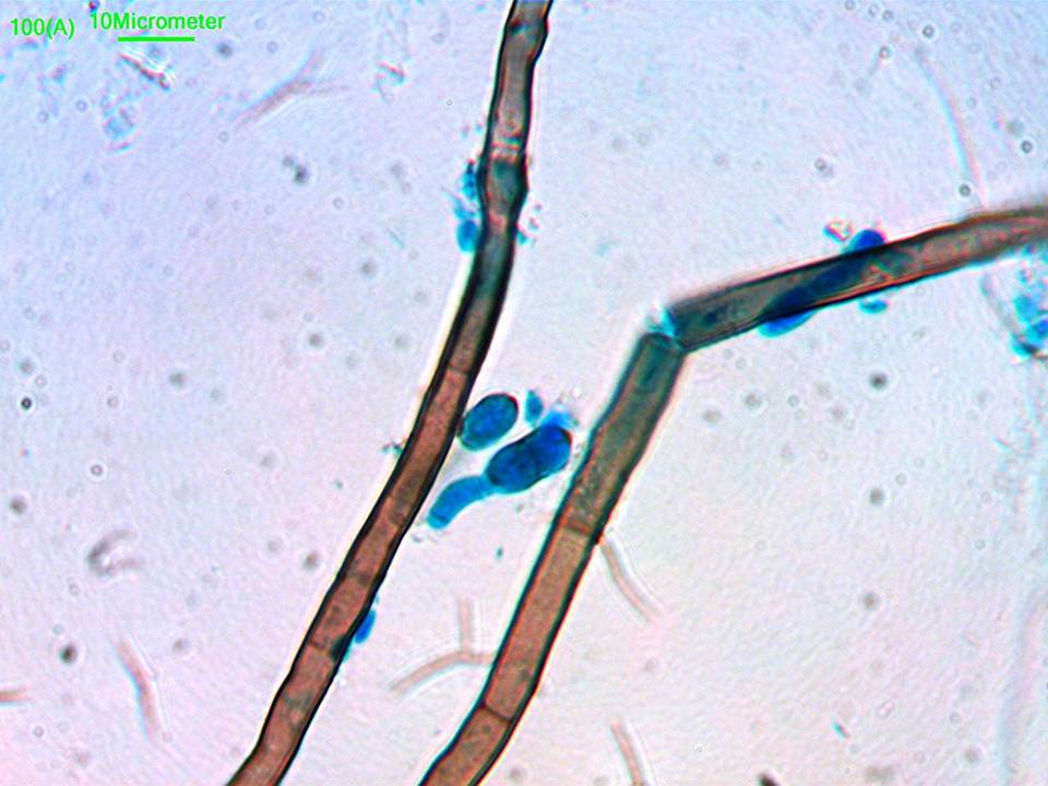Veronaea image