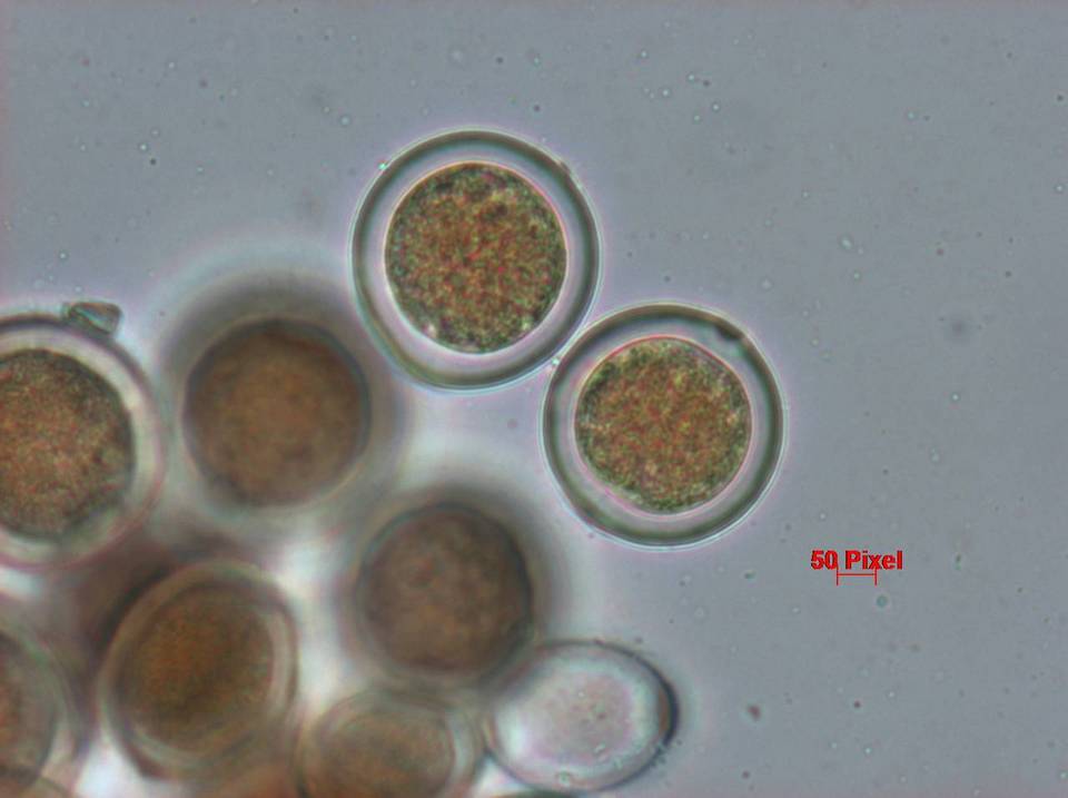 Sphaerosporium lignatile image