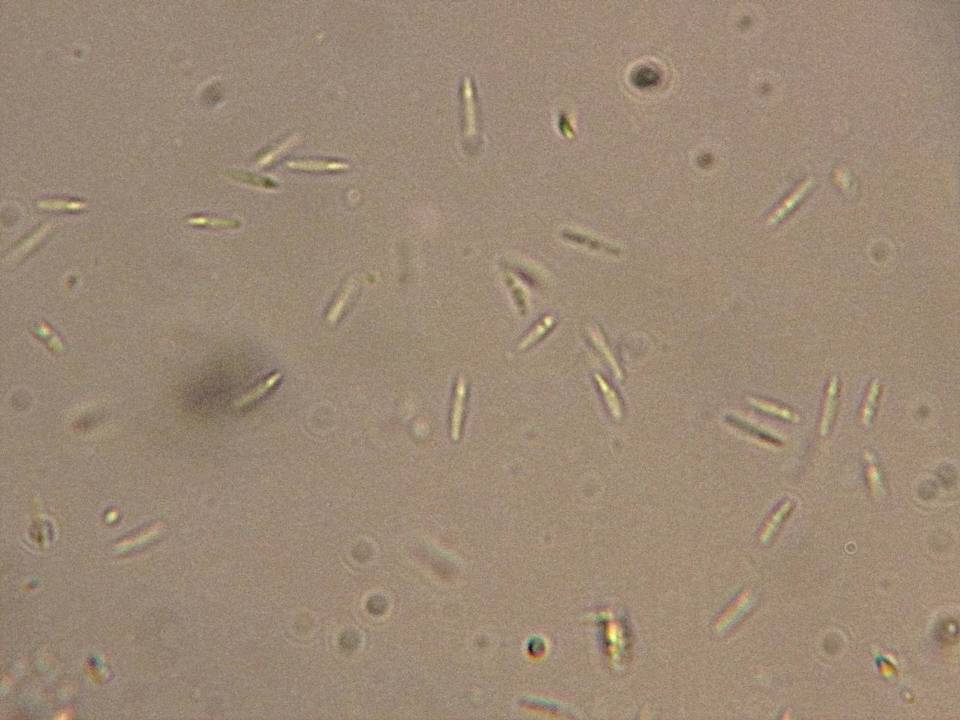 Orbilia sarraziniana image