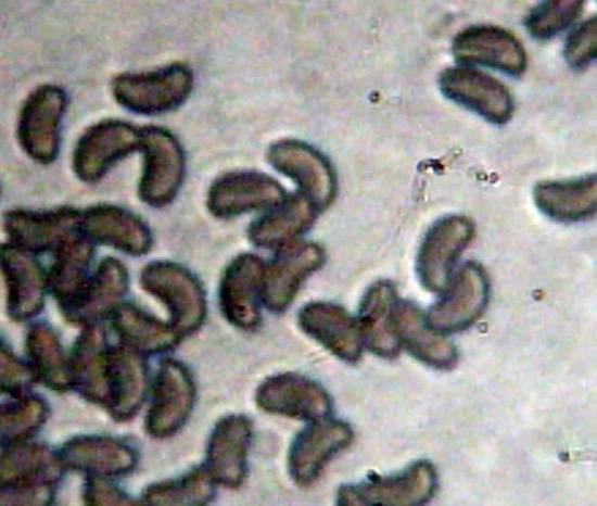 Leprieuria bacillum image