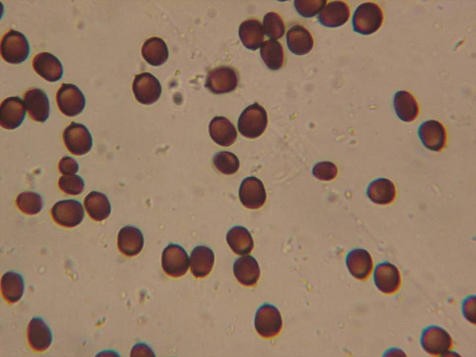 Coprinopsis gonophylla image