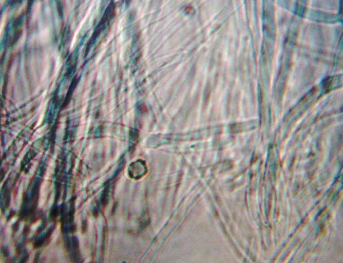 Coremiella cubispora image