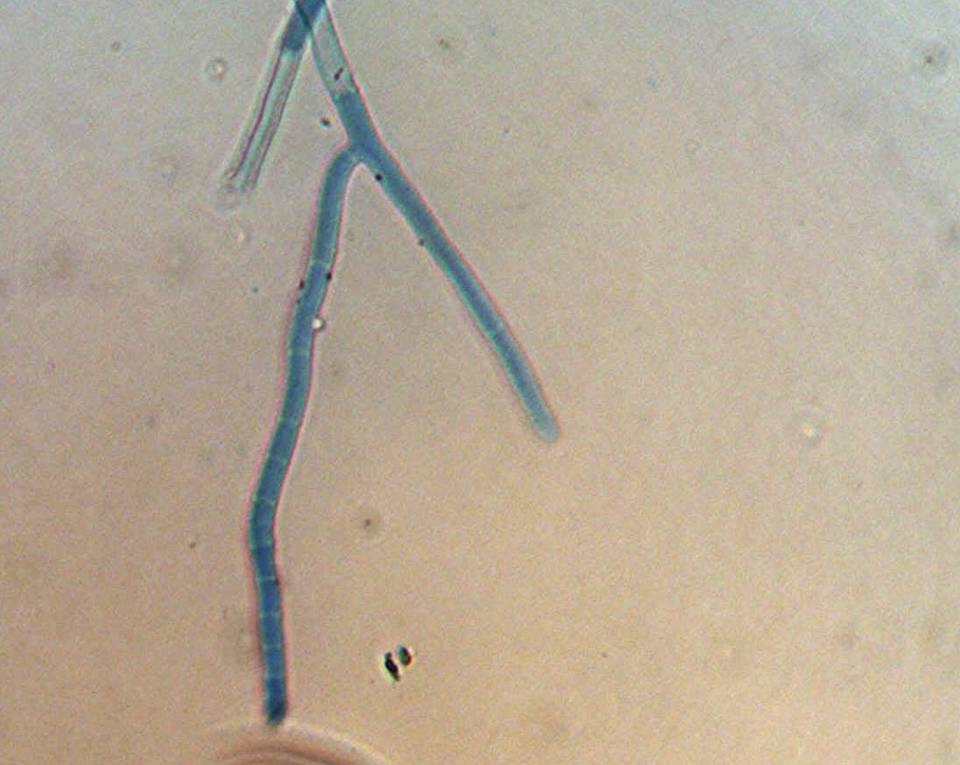 Coremiella cubispora image