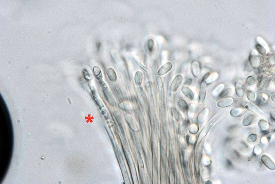 Basidiopycnides albertensis image