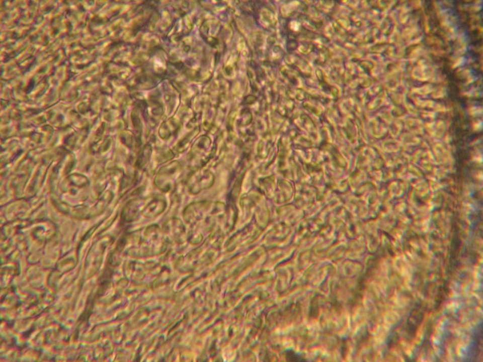 Endogone lactiflua image