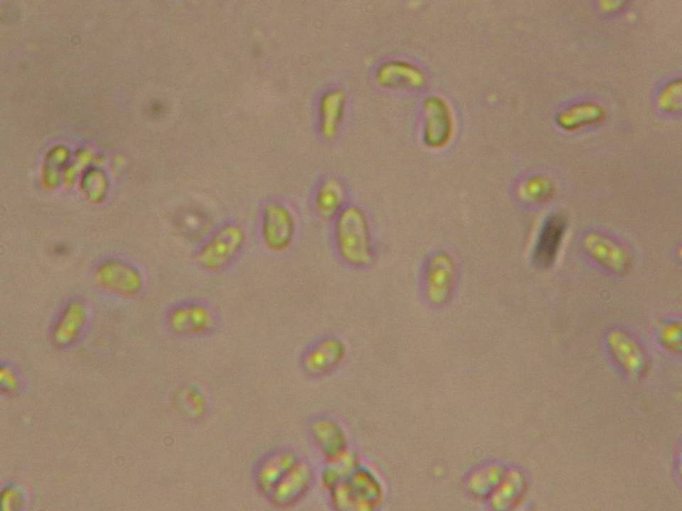 Cystolepiota moelleri image