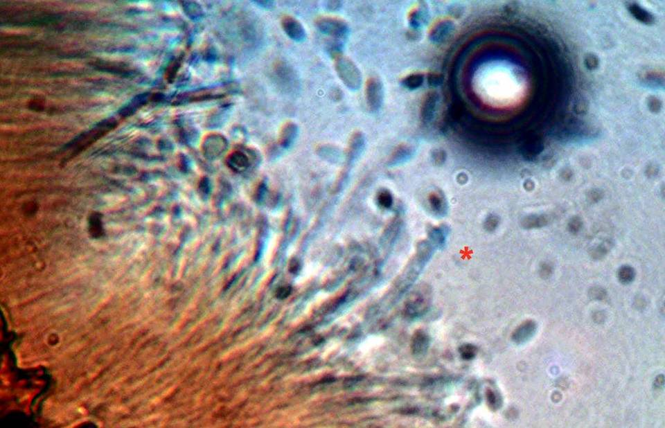 Stilbella annulata image