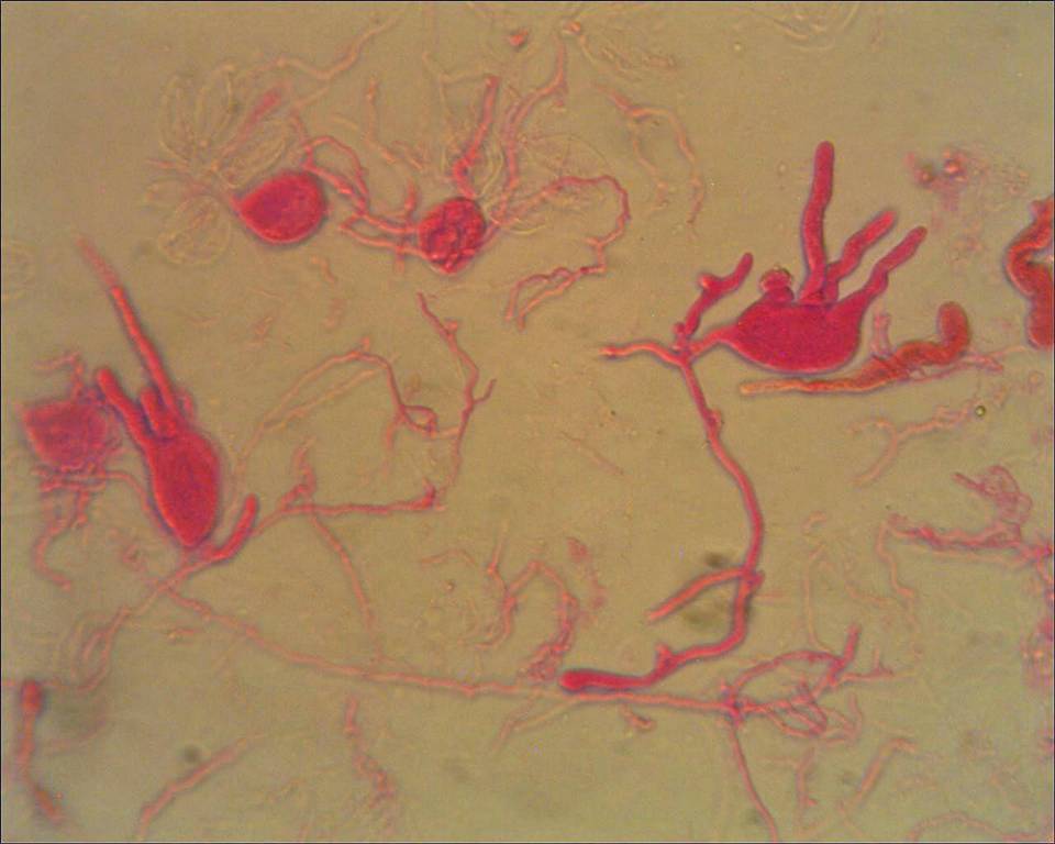 Tremella globispora image