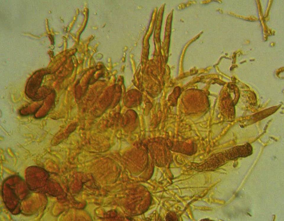 Tremella globispora image