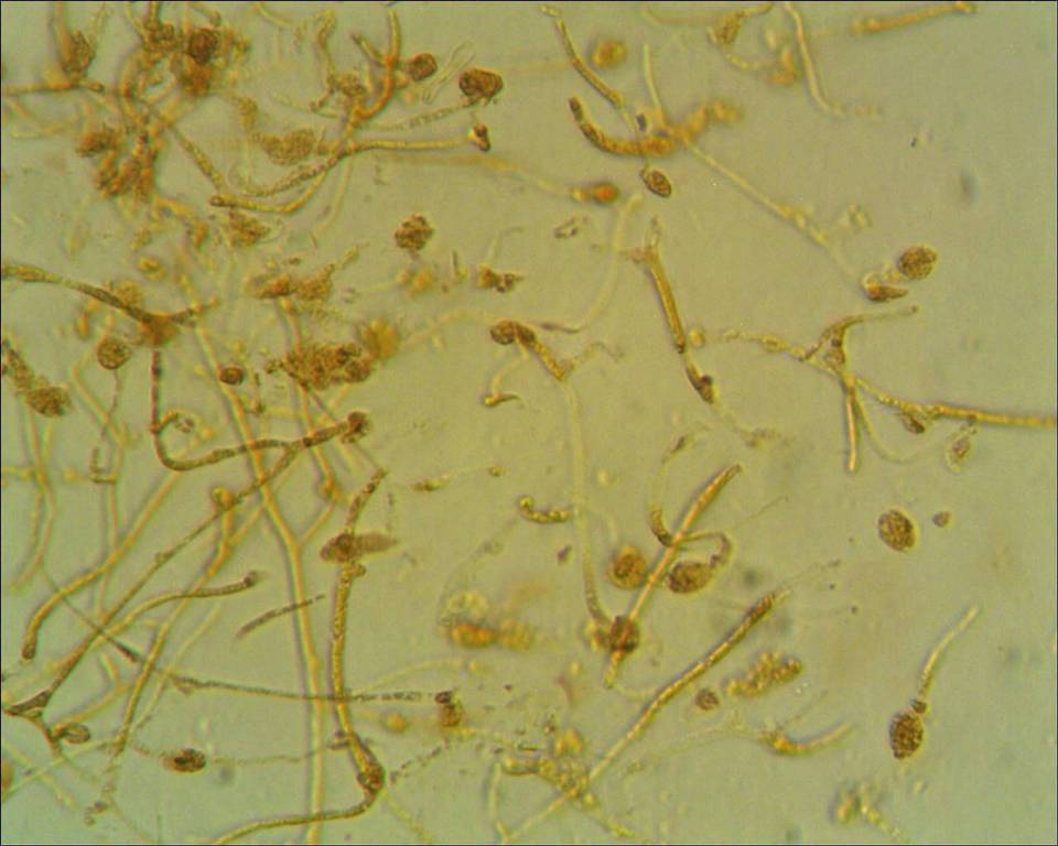 Tremella globispora image
