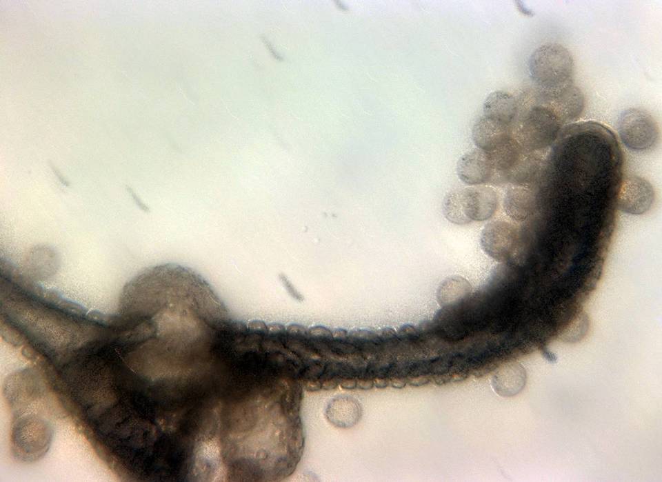 Lycogala image