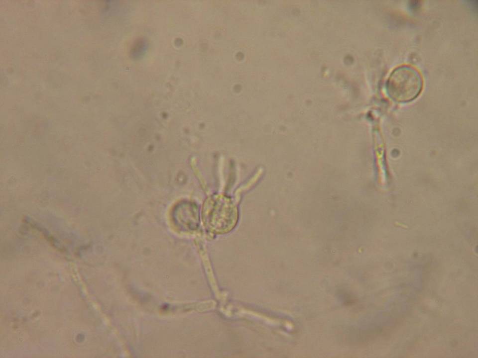 Exidiopsis grisea image