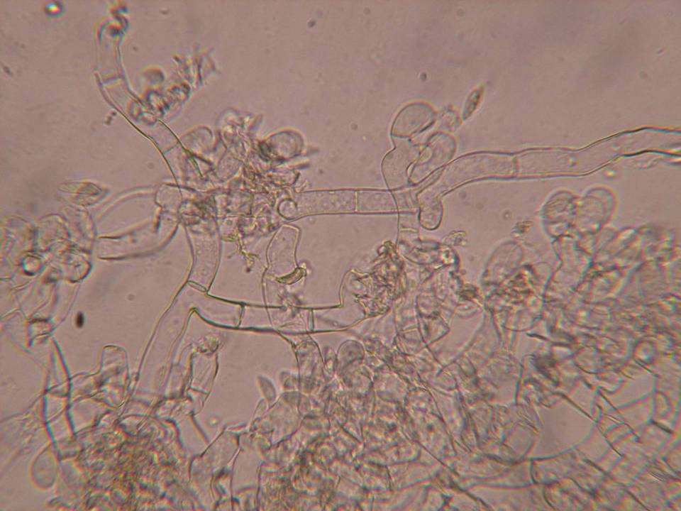 Botryobasidium vagum image