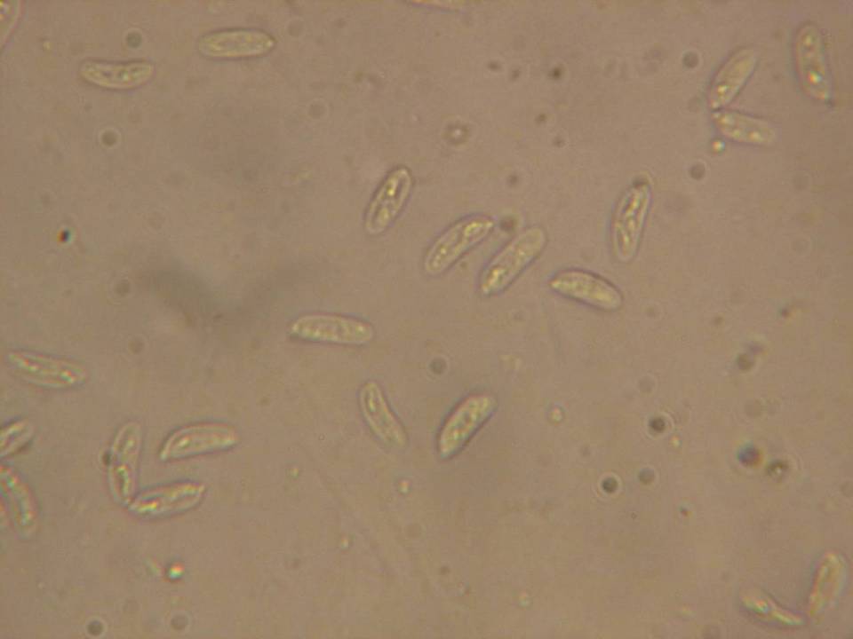 Gloeocystidiellum leucoxanthum image