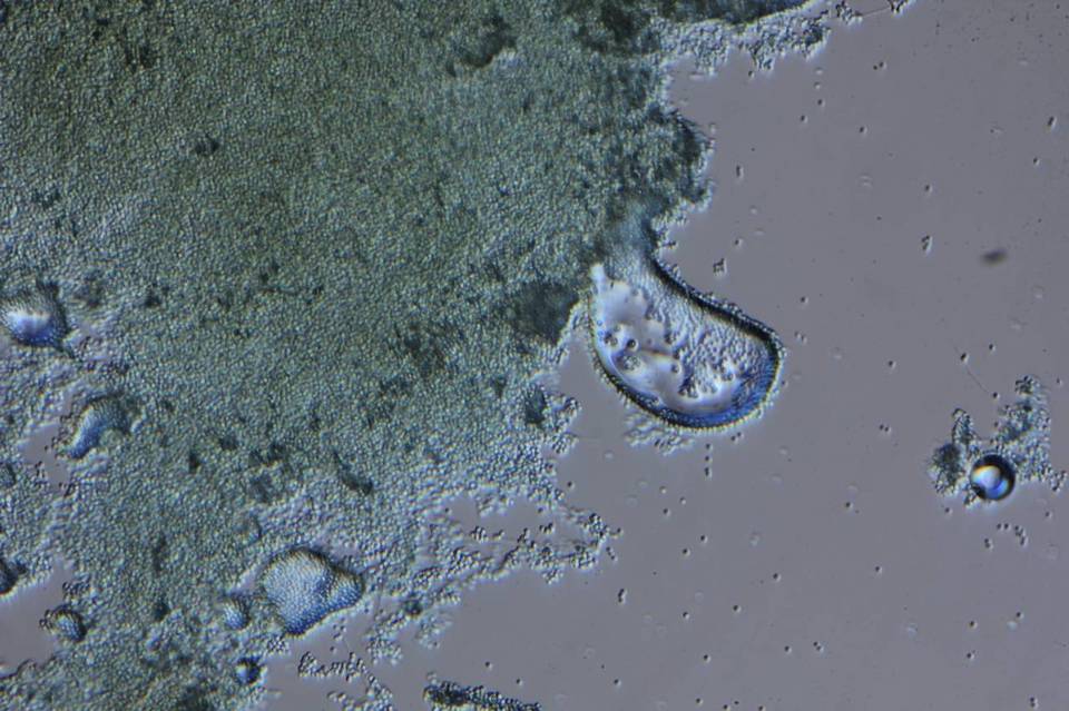 Penicillium melinii image