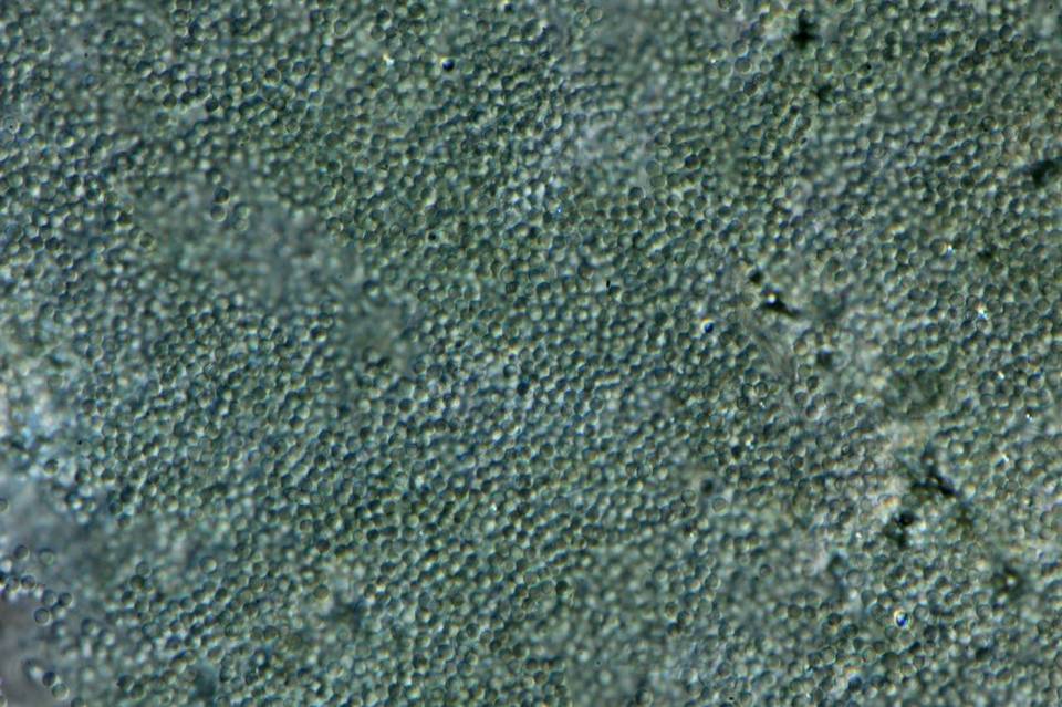 Penicillium melinii image