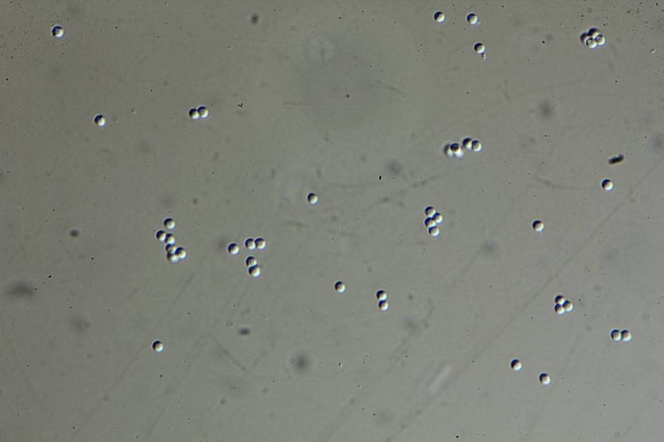 Penicillium melinii image