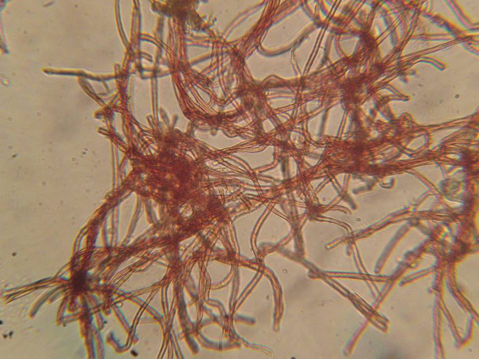 Patinellaria sanguinea image
