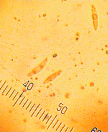 Lachnellula abietis image