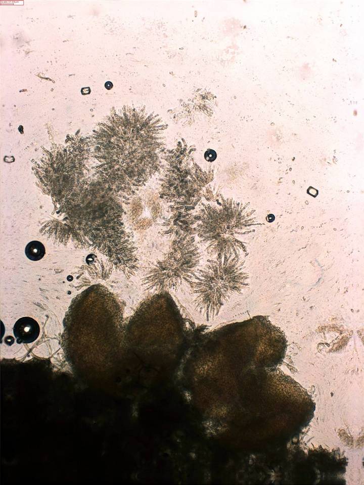 Nectria peziza image