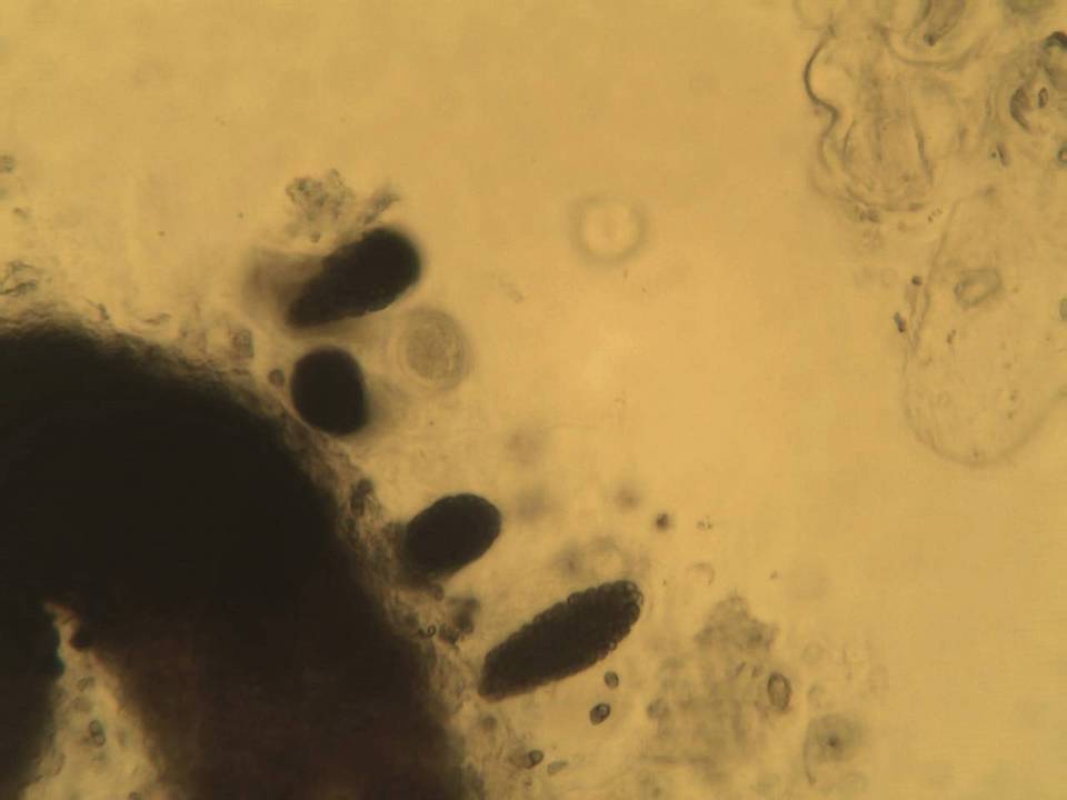 Sclerococcum image