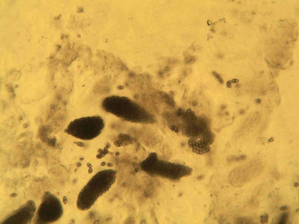 Sclerococcum sphaerale image