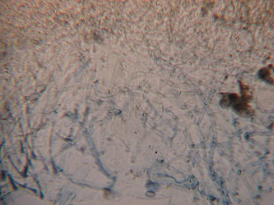 Pachyella babingtonii image