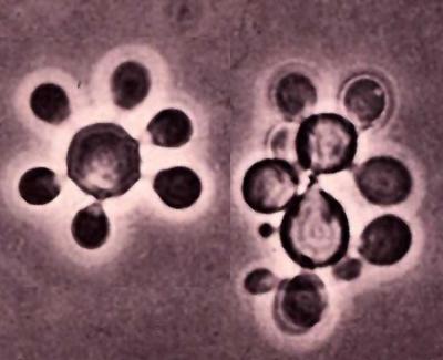 Paracoccidioides brasiliensis image