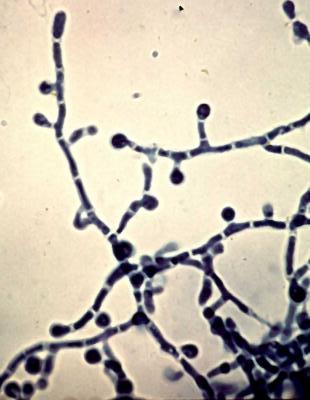 Paracoccidioides brasiliensis image