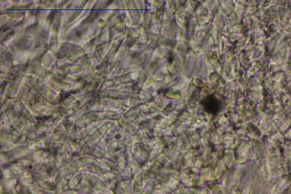 Lachnum abnormis image