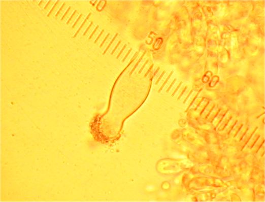 Strobilurus stephanocystis image
