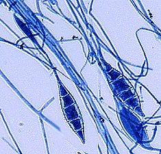 Microsporum canis image