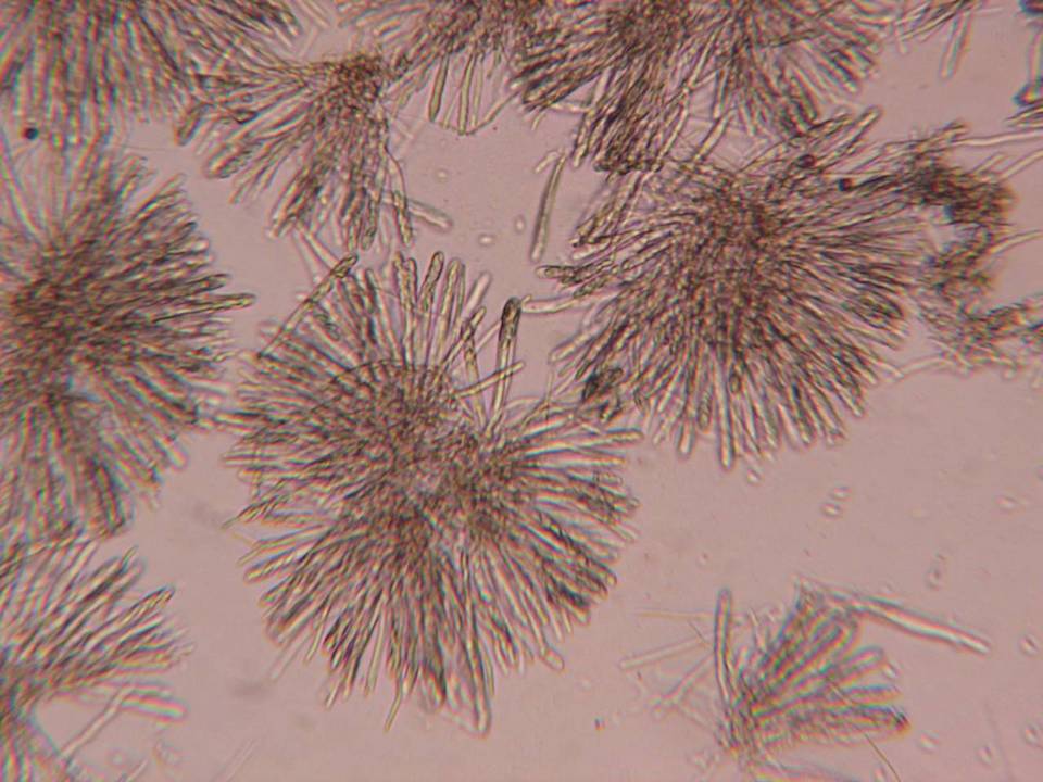 Lachnellula subtilissima image