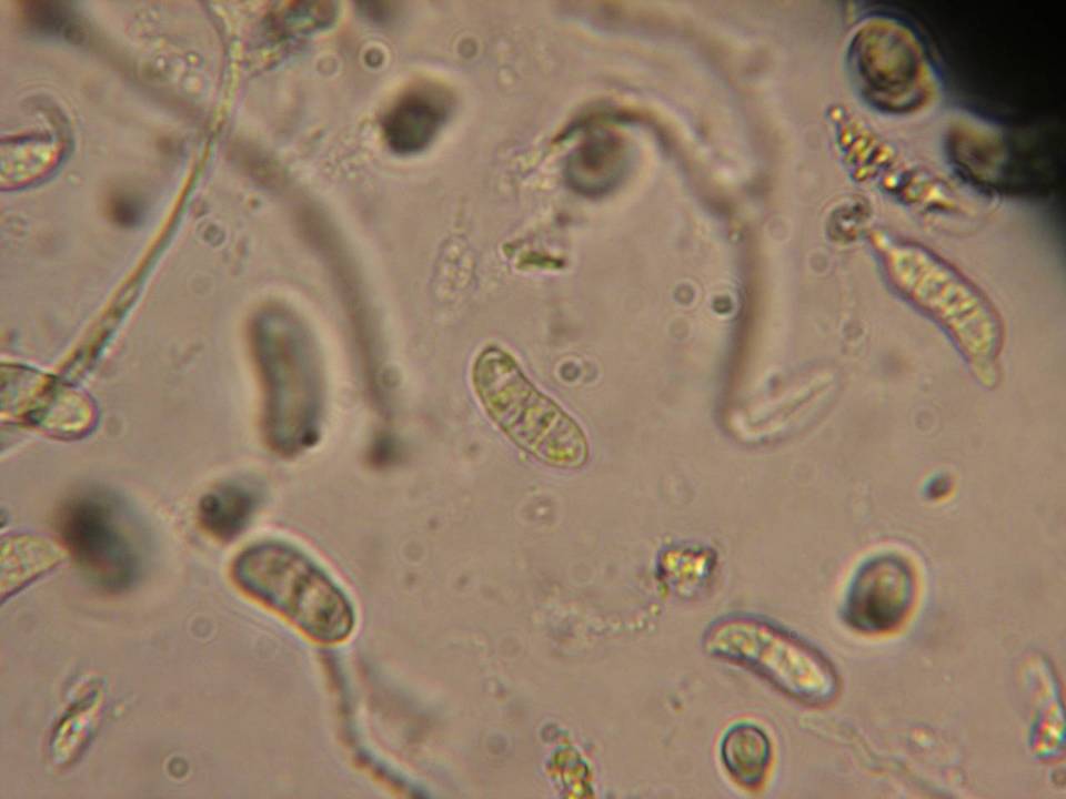 Dacrymyces minor image