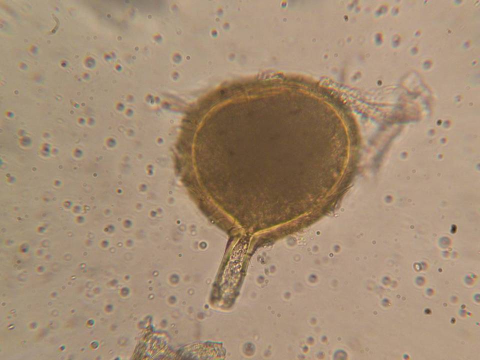 Rhizophagus fasciculatus image