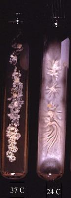 Blastomyces dermatitidis image
