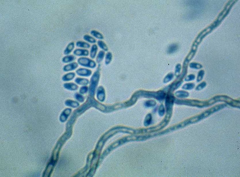Exophiala jeanselmei image