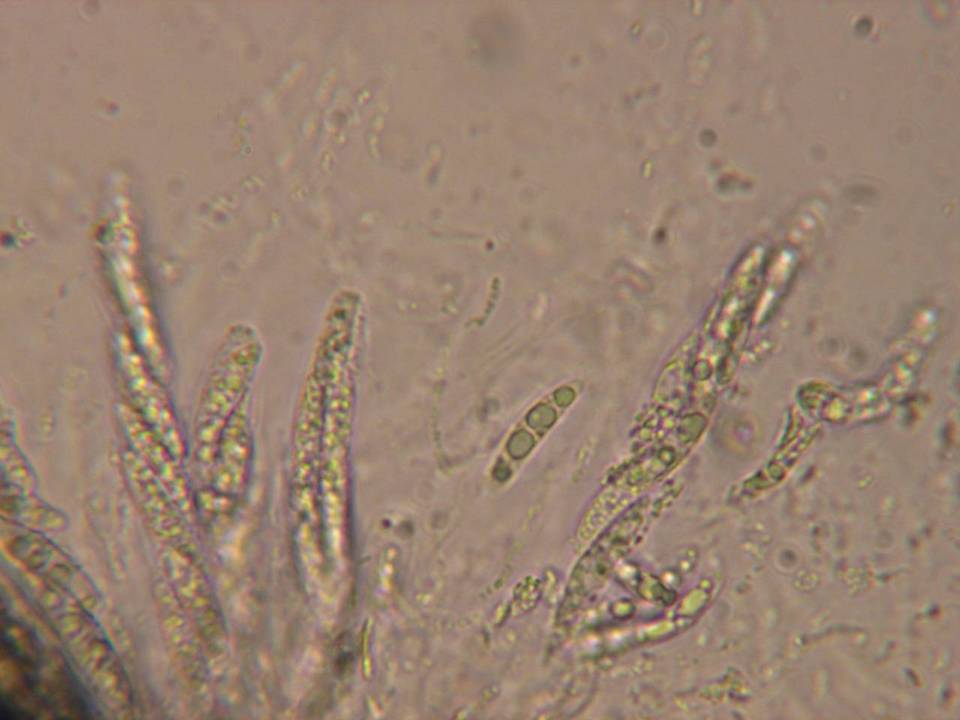 Chaetosphaeria ovoidea image