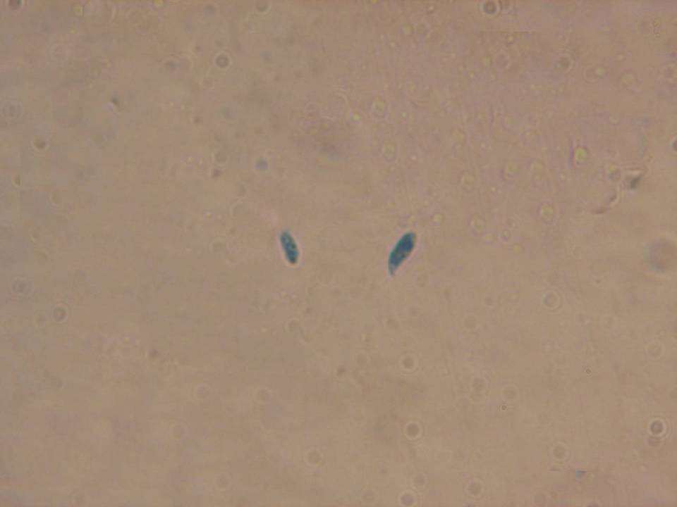 Flammulaster fusisporus image