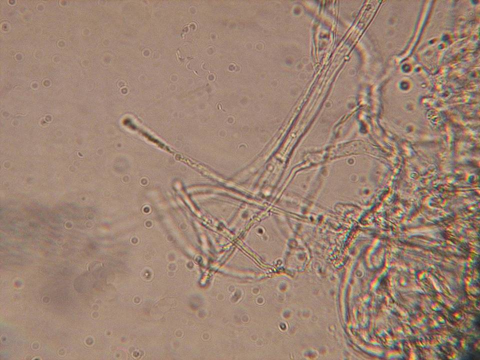 Entoloma cephalotrichum image