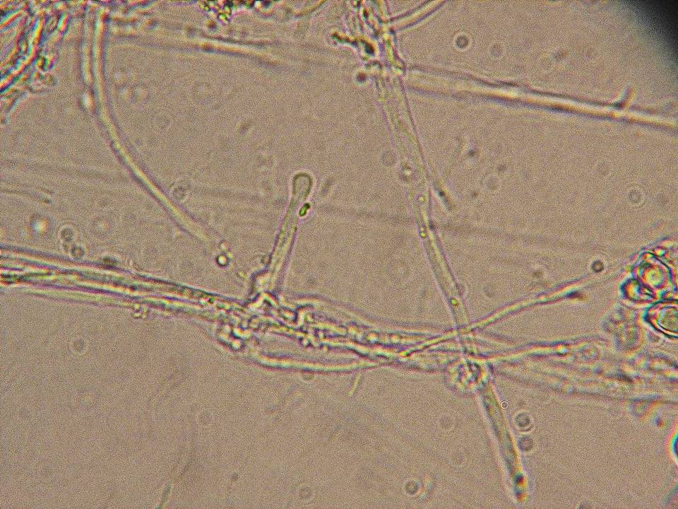 Entoloma cephalotrichum image