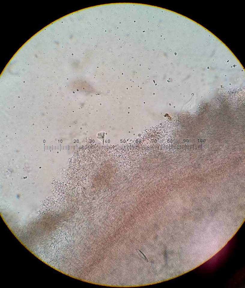 Coryne dubia image